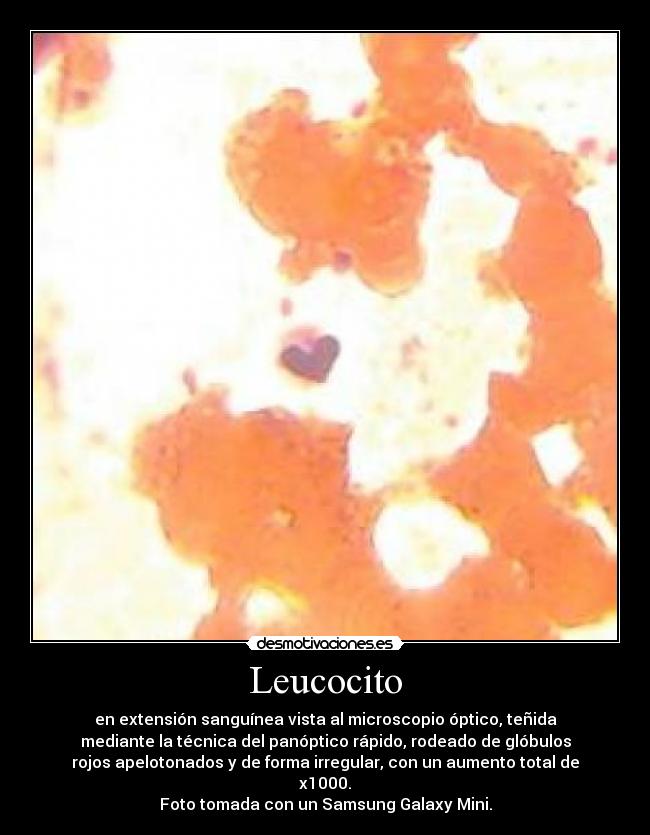 Leucocito - 