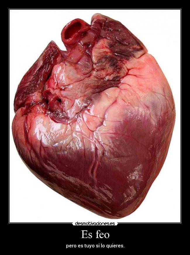 Es feo - pero es tuyo si lo quieres.