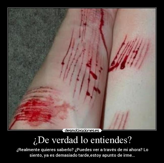 ¿De verdad lo entiendes? - ¿Realmente quieres saberlo? ¿Puedes ver a través de mi ahora? Lo
siento, ya es demasiado tarde,estoy apunto de irme...