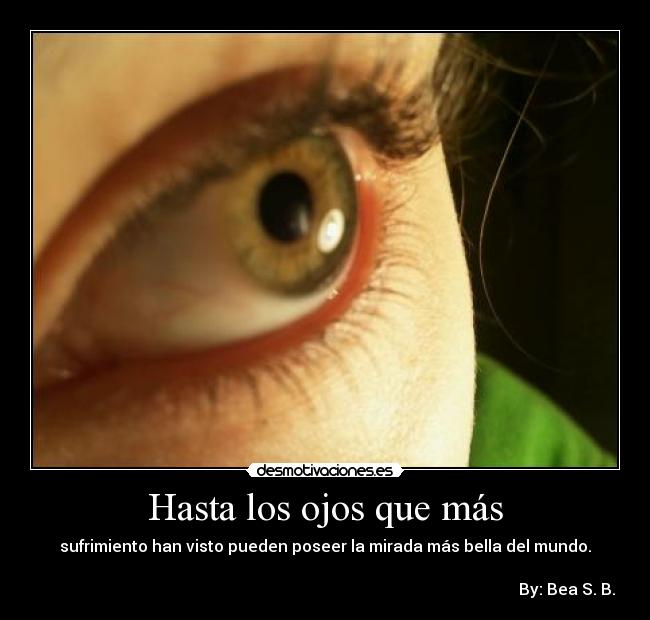 Hasta los ojos que más - sufrimiento han visto pueden poseer la mirada más bella del mundo.
By: Bea S. B.