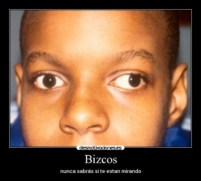Bizcos - nunca sabrás si te estan mirando