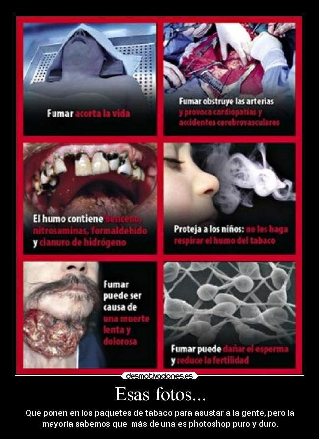 Esas fotos... -