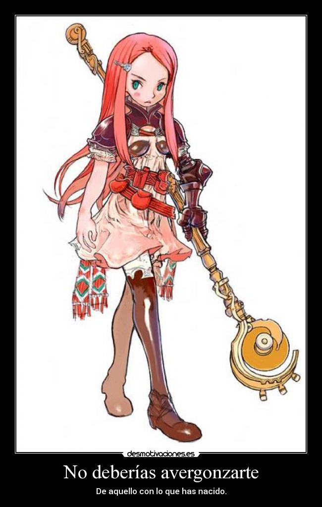 No deberías avergonzarte - 