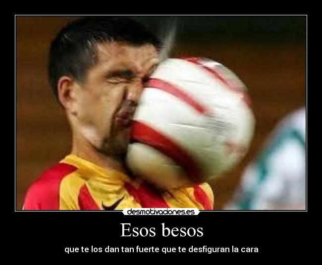 Esos besos - que te los dan tan fuerte que te desfiguran la cara