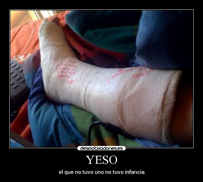 YESO - el que no tuvo uno no tuvo infancia