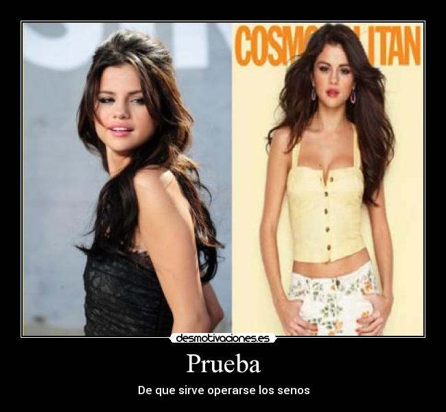 Lista 99+ Foto Fotos De Cicatrices De Senos Operados Lleno