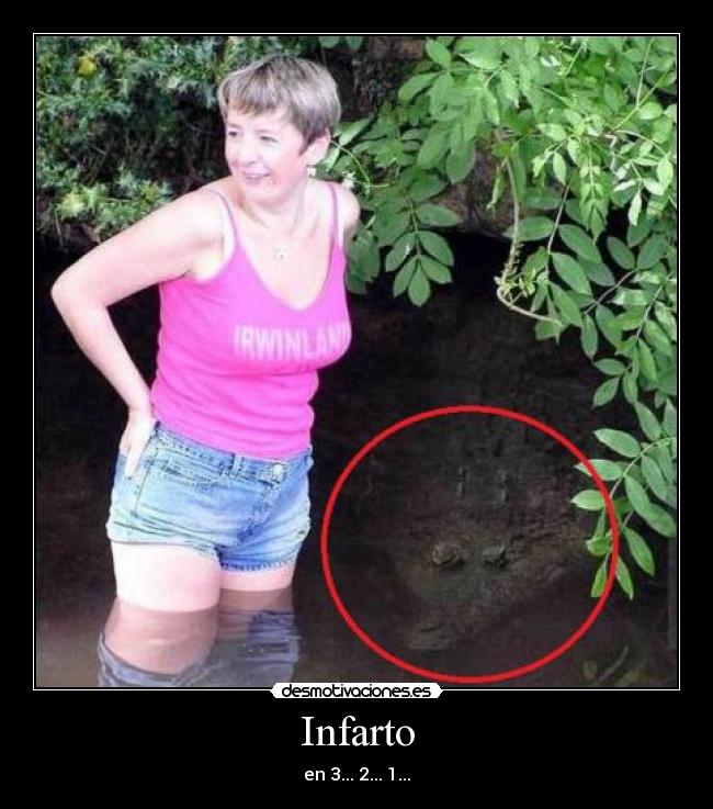 Infarto -