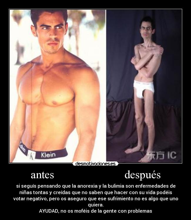 antes                        después - 