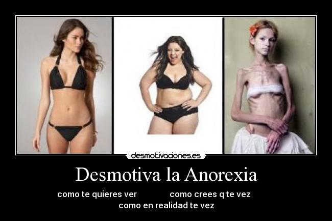 Desmotiva la Anorexia -