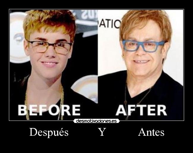 Después Y Antes -