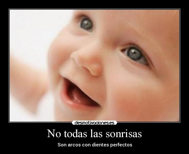 No todas las sonrisas - Son arcos con dientes perfectos