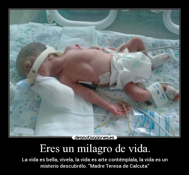 Eres un milagro de vida. - 