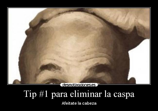 Tip #1 para eliminar la caspa - Afeitate la cabeza