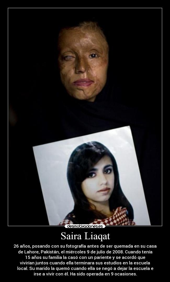 Saira Liaqat - 26 años, posando con su fotografía antes de ser quemada en su casa
de Lahore, Pakistán, el miércoles 9 de julio de 2008. Cuando tenía
15 años su familia la casó con un pariente y se acordó que
vivirían juntos cuando ella terminara sus estudios en la escuela
local. Su marido la quemó cuando ella se negó a dejar la escuela e
irse a vivir con él. Ha sido operada en 9 ocasiones.