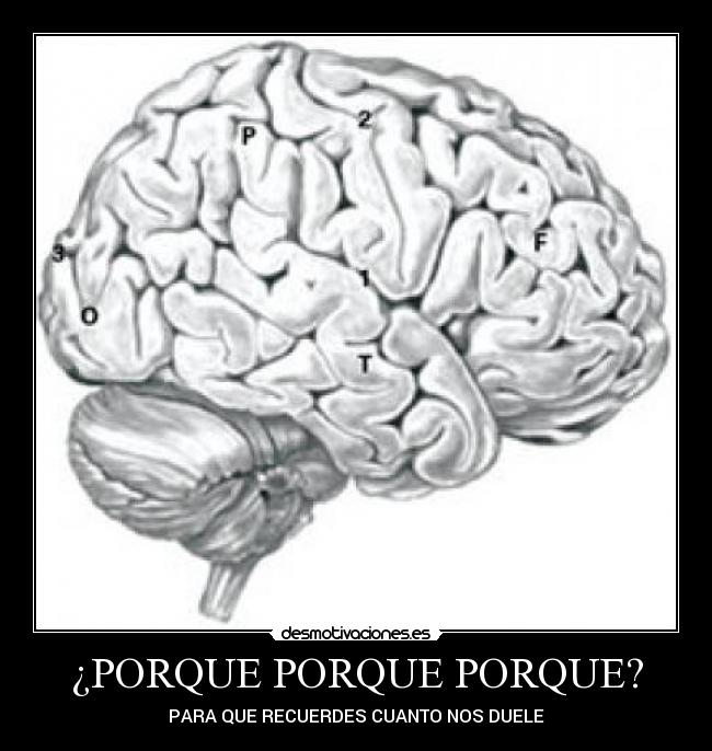 ¿PORQUE PORQUE PORQUE? - PARA QUE RECUERDES CUANTO NOS DUELE