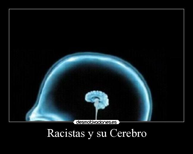Racistas y su Cerebro - 