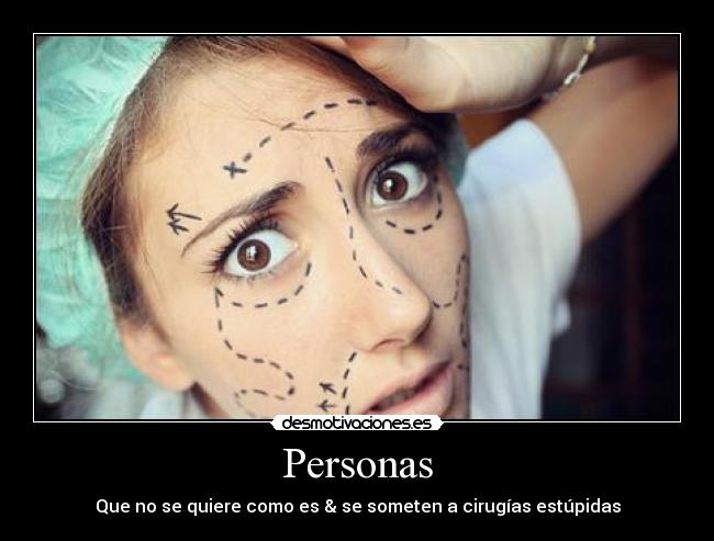 Personas - Que no se quiere como es & se someten a cirugías estúpidas