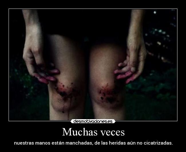 Muchas veces - nuestras manos están manchadas, de las heridas aún no cicatrizadas.
