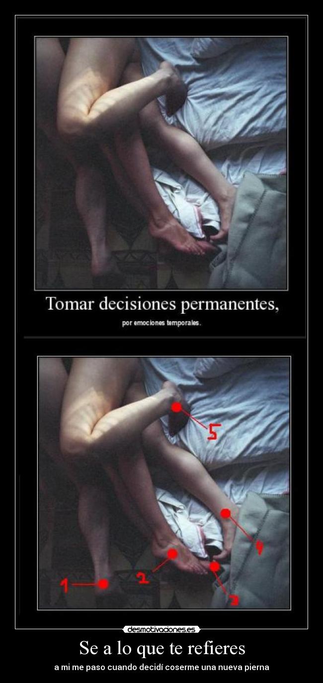 Se a lo que te refieres -