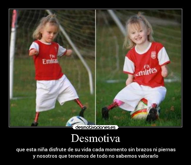 Desmotiva - que esta niña disfrute de su vida cada momento sin brazos ni piernas
y nosotros que tenemos de todo no sabemos valorarlo