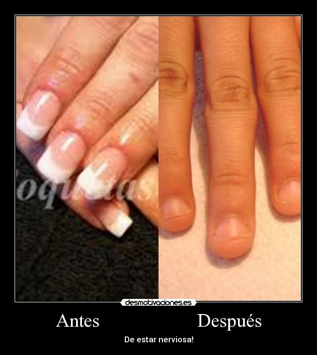 Antes                    Después - 