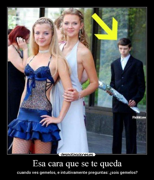 Esa cara que se te queda - cuando ves gemelos, e intuitivamente preguntas: ¿sois gemelos?
