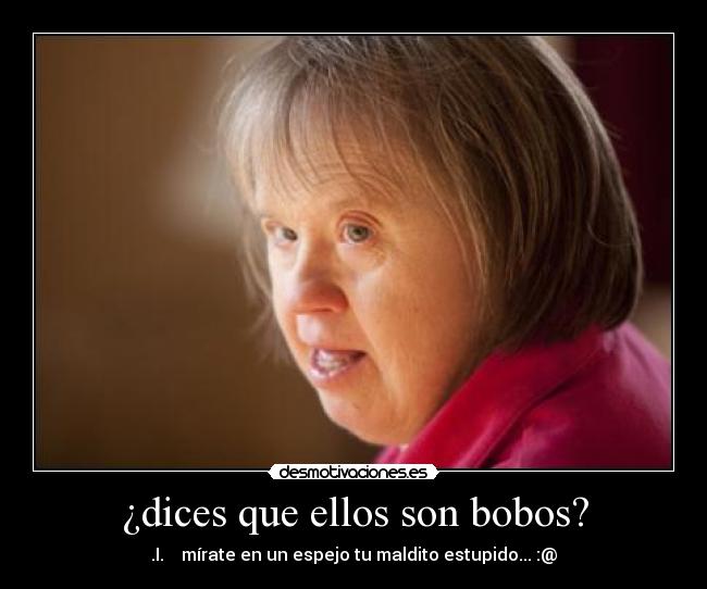 ¿dices que ellos son bobos? -