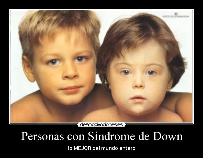 Personas con Sindrome de Down -