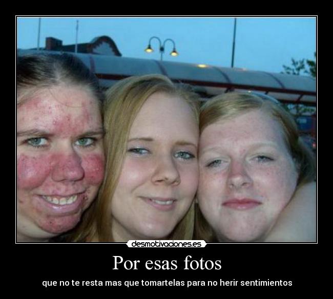 Por esas fotos - que no te resta mas que tomartelas para no herir sentimientos