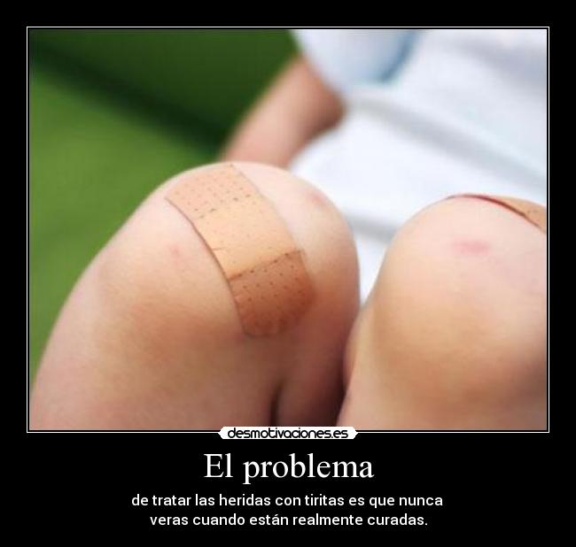 El problema - de tratar las heridas con tiritas es que nunca 
veras cuando están realmente curadas.