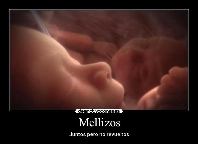 Mellizos - Juntos pero no revueltos