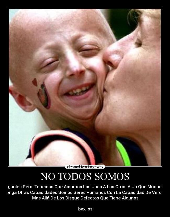 NO TODOS SOMOS - Iguales Pero  Tenemos Que Amarnos Los Unos A Los Otros A Un Que Muchos
Tenga Otras Capacidades Somos Seres Humanos Con La Capacidad De Verdad
Mas Allá De Los Disque Defectos Que Tiene Algunos

by:Jios