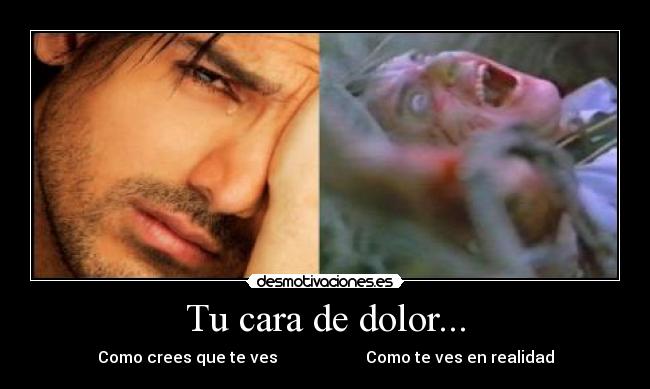Tu cara de dolor... -
