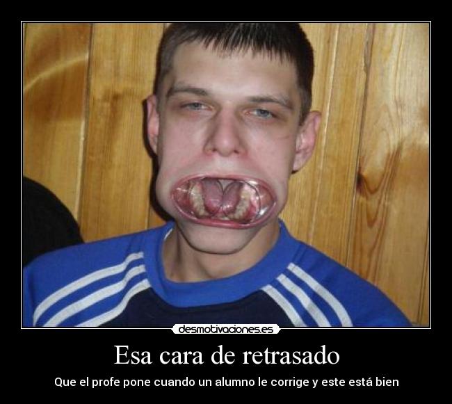 Esa cara de retrasado - Que el profe pone cuando un alumno le corrige y este está bien