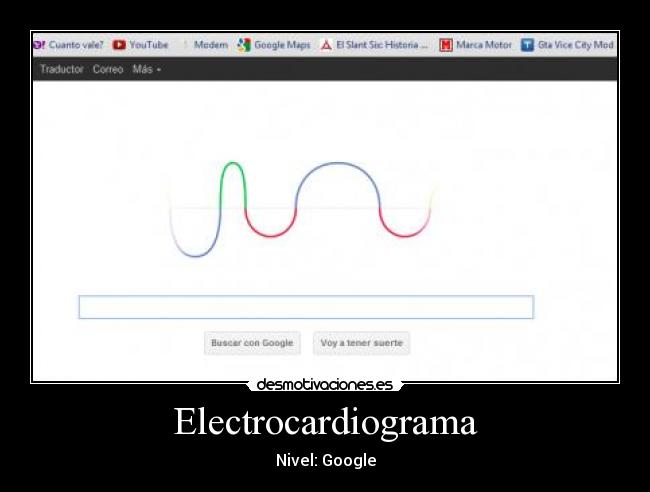 Electrocardiograma -