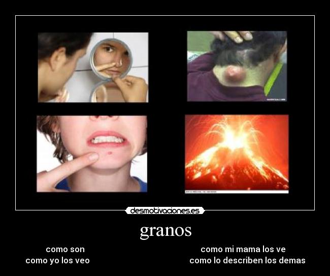 granos - 