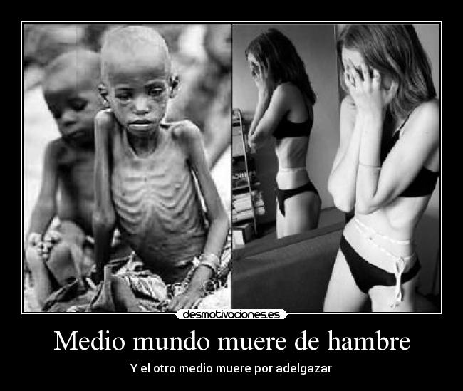 Medio mundo muere de hambre - Y el otro medio muere por adelgazar