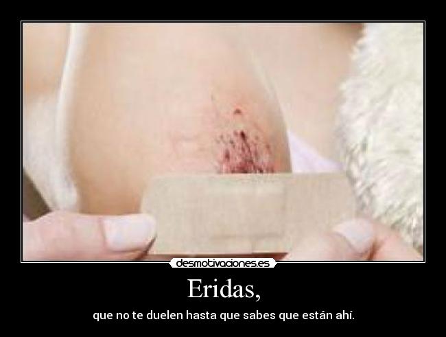 Eridas, - que no te duelen hasta que sabes que están ahí.