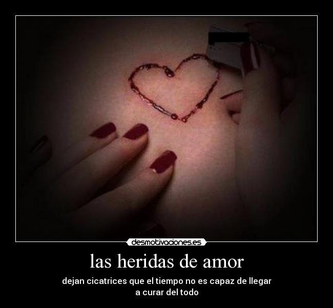 las heridas de amor - dejan cicatrices que el tiempo no es capaz de llegar
a curar del todo