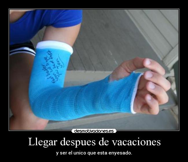 Llegar despues de vacaciones - y ser el unico que esta enyesado.