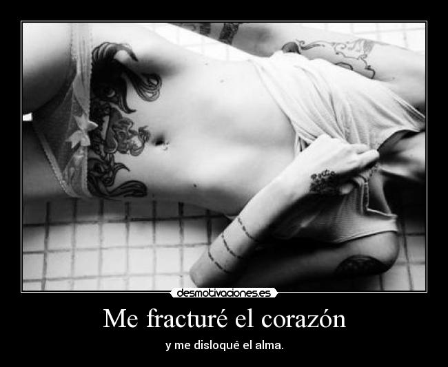 Me fracturé el corazón - 
