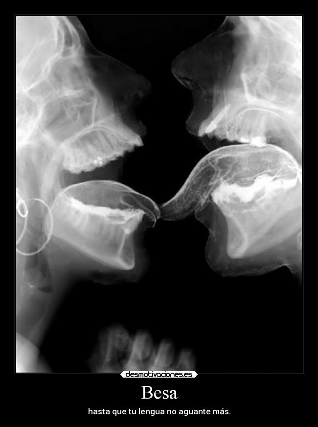 Besa - hasta que tu lengua no aguante más.