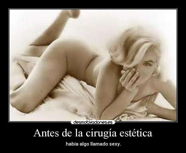 Antes de la cirugía estética -