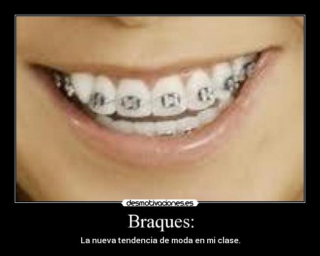 Braques: - 