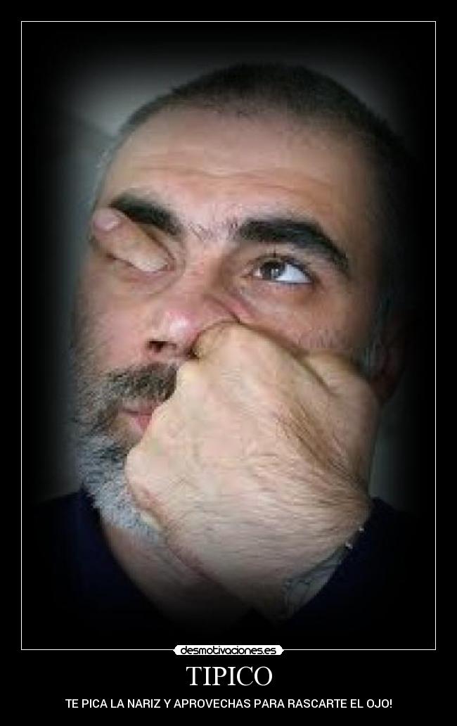 TIPICO - TE PICA LA NARIZ Y APROVECHAS PARA RASCARTE EL OJO!
