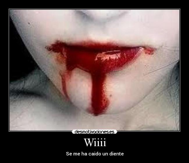 Wiiii - Se me ha caido un diente
