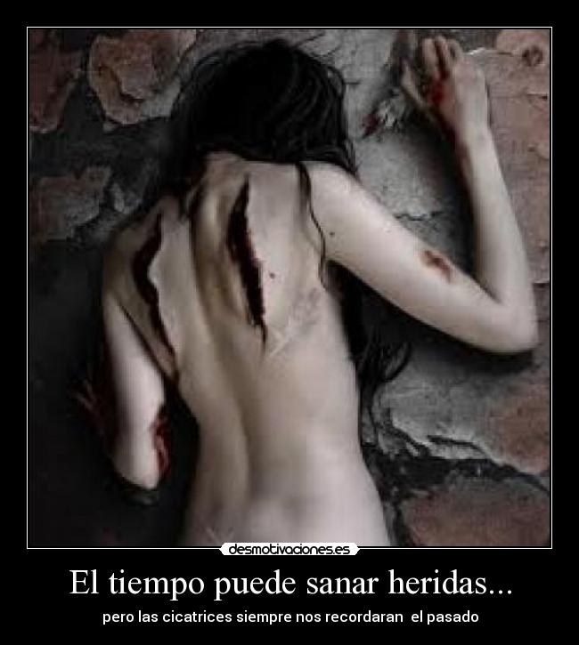 El tiempo puede sanar heridas... -
