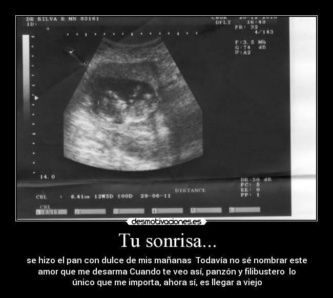 Tu sonrisa... -
