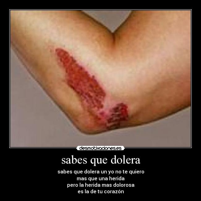 sabes que dolera - sabes que dolera un yo no te quiero
mas que una herida
pero la herida mas dolorosa
es la de tu corazón