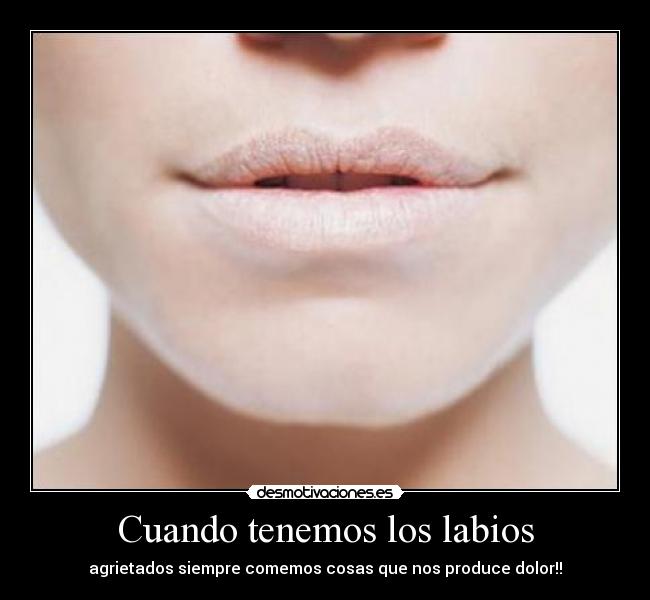 Cuando tenemos los labios - 